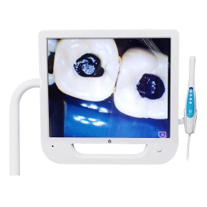 Video Intra Oral Camera သွားဘက်ဆိုင်ရာဆေးခန်းတက္ကသိုလ် VGA ဗီဒီယိုကိုသုံးပါ။