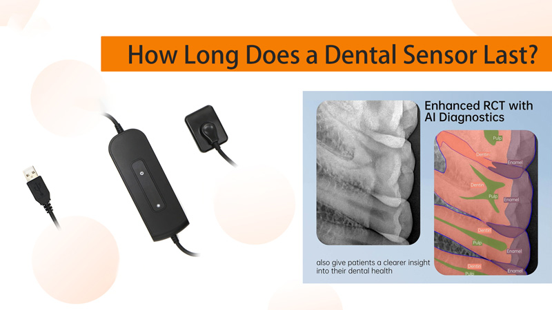 Unsa ka dugay ang usa ka dental sensor? Pagsabot sa CMOS Technology, Image Quality, ug Replacement Timing