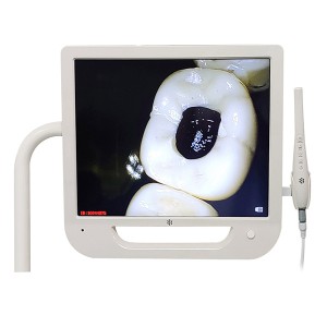 Sony Intra Oral Camera သွားဘက်ဆိုင်ရာဆေးခန်း တက္ကသိုလ်မှ Ultra High Definition ကို အသုံးပြုပါ။